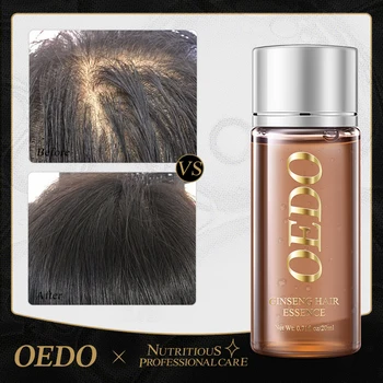 Эссенция для волос из женьшеня OEDO Способствует росту волос, предотвращает их выпадение, Восстанавливает сухие волосы, контролирует жирность, разглаживает волосы, эссенция для ухода за волосами